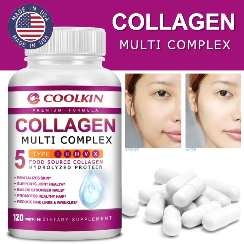 Coffee X - Collagen Multi Complex - Types I,